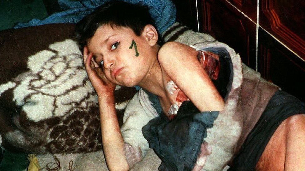 Маленький мальчик ожидает эвакуации из Сребреницы в 1993 году