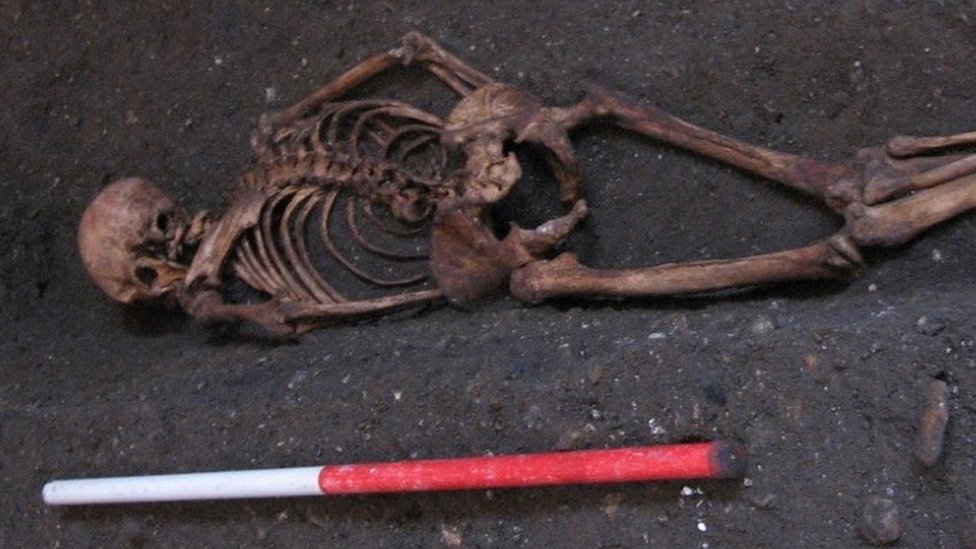 скелет в Кембридже Святого Иоанна