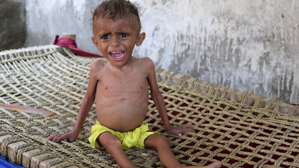 مخاطر المجاعة في اليمن