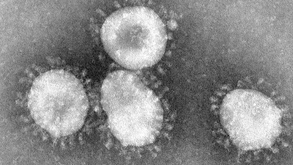 Koronavirusi su grupa virusa koji kad se gledaju pod mikroskopom imaju oreol nalik kruni (koroni)
