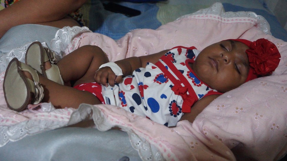 Фотография Валентины, ребенка, рожденного с микроцефалией
