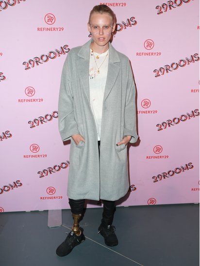 Cinco años después, Wasser convive con un dolor diario que describe como "horroroso" y que le dificulta poder caminar. Lauren Wasser, modelo y activista