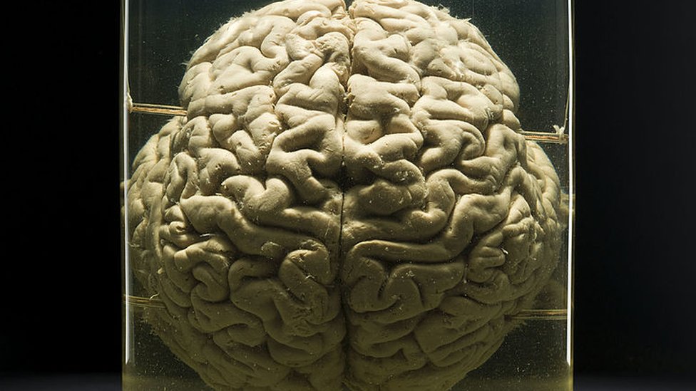 cerebro