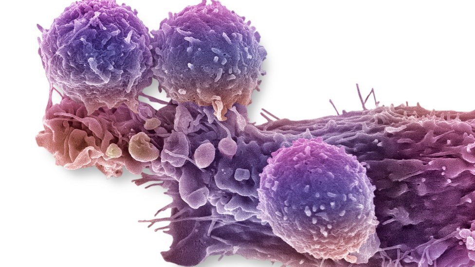 Иммунные клетки, атакующие раковые ткани