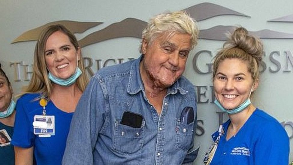 Jay Leno: Comedian released from hospital after being burned in fire