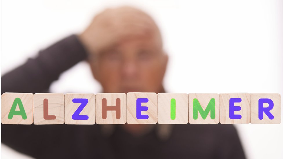 Cubos con letras que forman la palabra Alzheimer