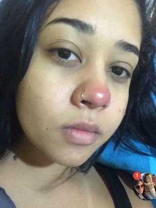 Layane Dias con una bola roja en la nariz.