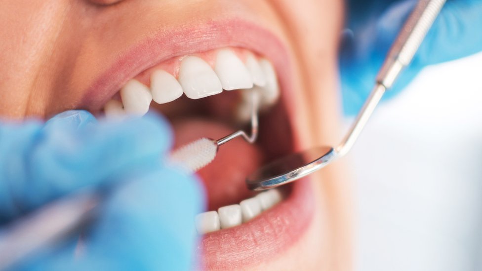 Boca aberta para examinação de dentista