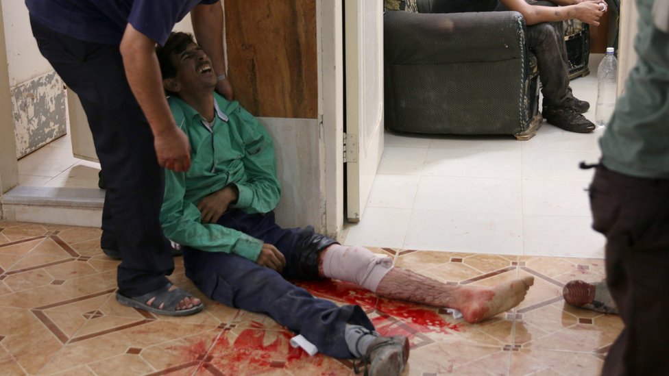 Человеку, пострадавшему в результате правительственного авиаудара, оказывается помощь в полевом госпитале в провинции Дераа, Сирия (18 сентября 2016 г.)
