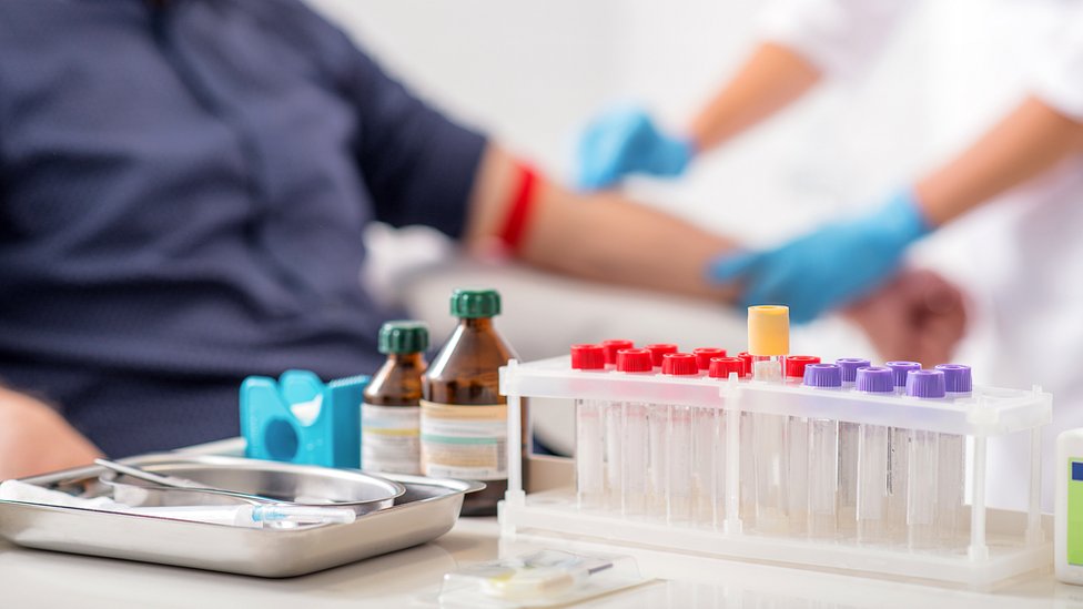 Una sustancia química generada en el cerebro está relacionada con los síntomas de la migraña. Paciente en el laboratorio.