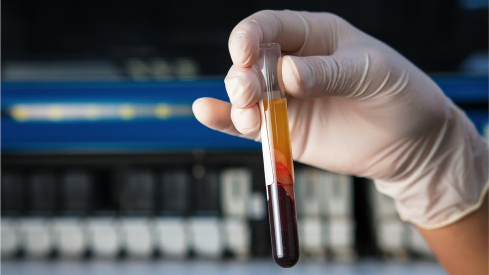 Testing blood for cancer