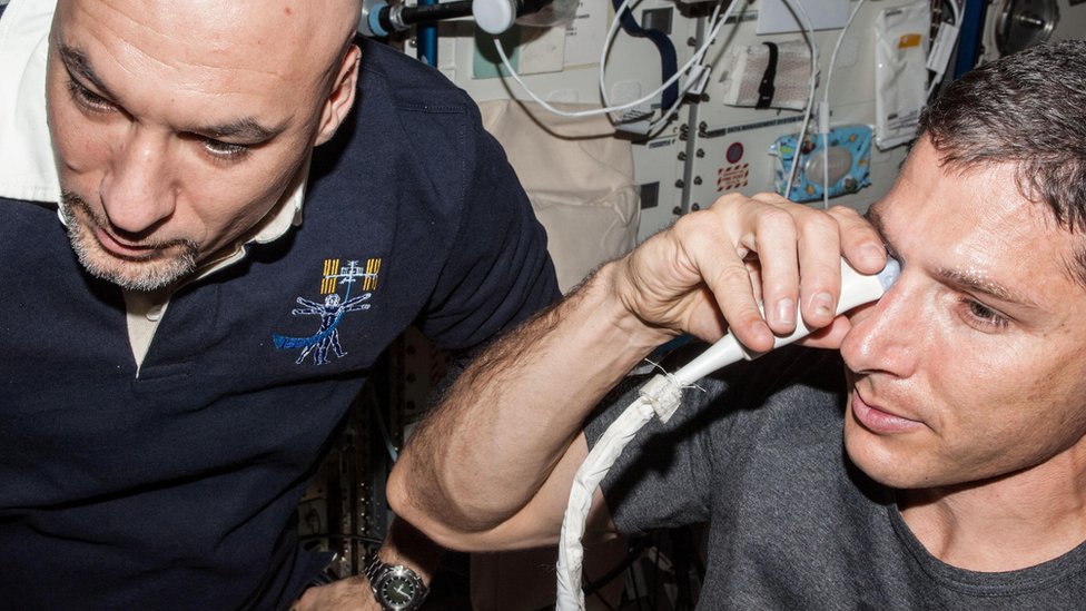 Examen de visión al astronauta Michael Hopkins en la Estación Espacial Internacional