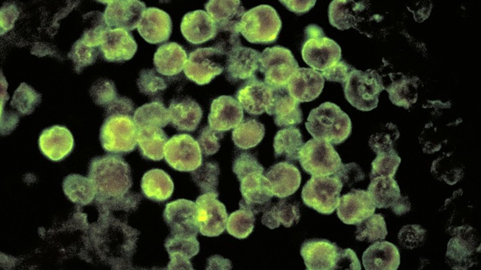 صورة مجهرية للنيجلرية الدجاجية