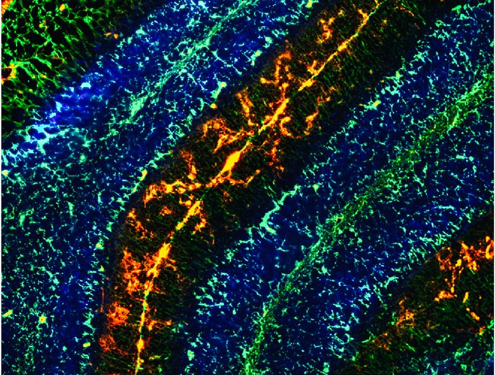 Изображение клеток мозжечка в мозге мыши
