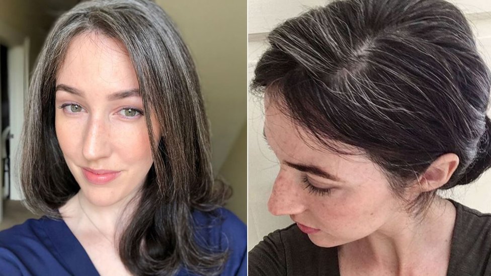 Fotografías de Martha mostrando el progreso del cabello