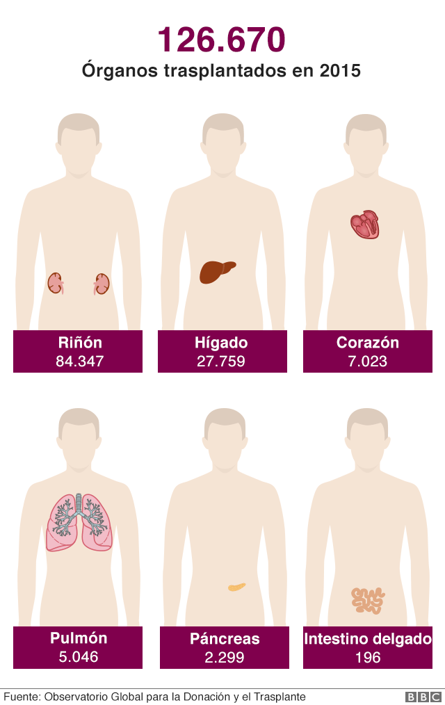 Ilustración de trasplantes de órganos en el mundo en 2015