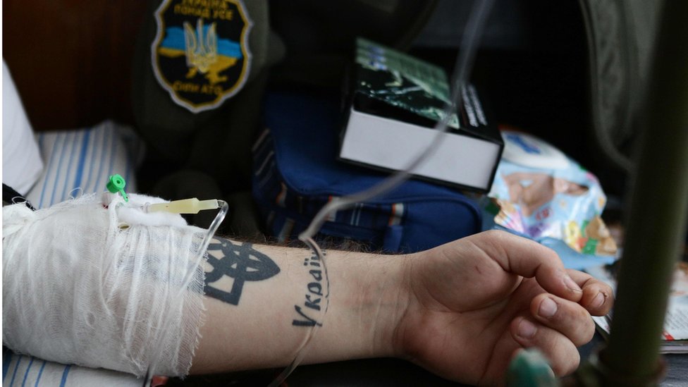 Український військовий у госпіталі у Покровську, лютий 2017 року
