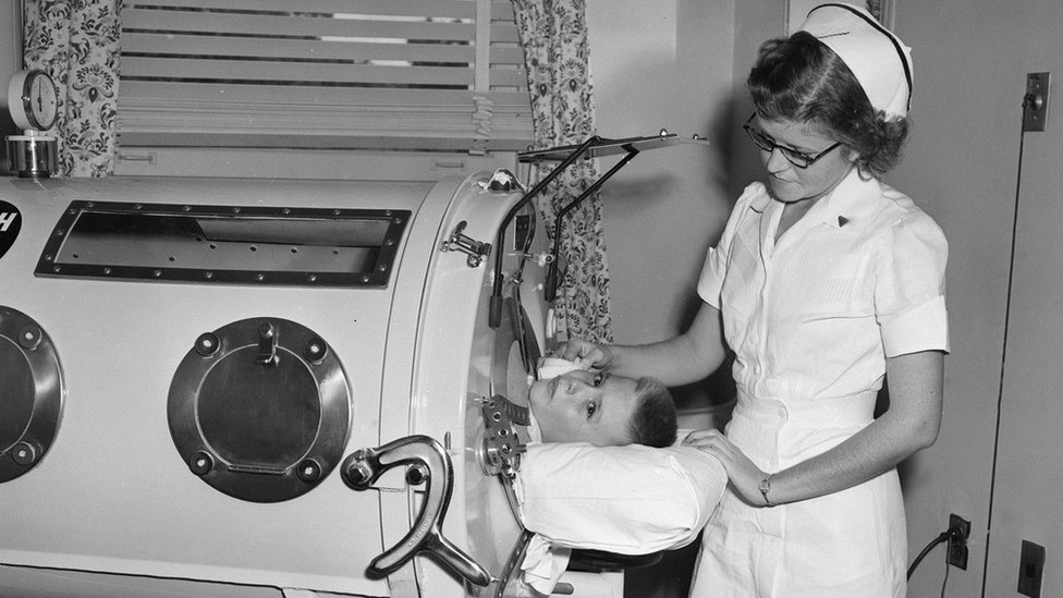 Pacijenti s poliom morali su da izdrže duge i neprijatne tretmane u mašinama zvanim železna pluća, pre nego što su razvijeni prenosivi ventilatori