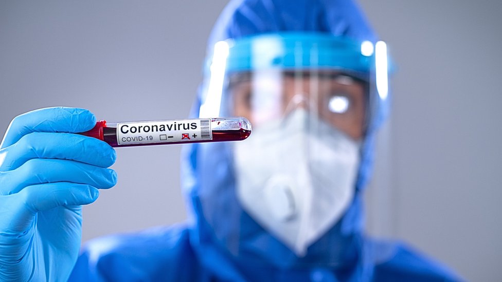 Contagio de covid-19: por qué los casos de reinfección de coronavirus no  sorprenden a los científicos y no deberían ser motivo de alarma - BBC News  Mundo