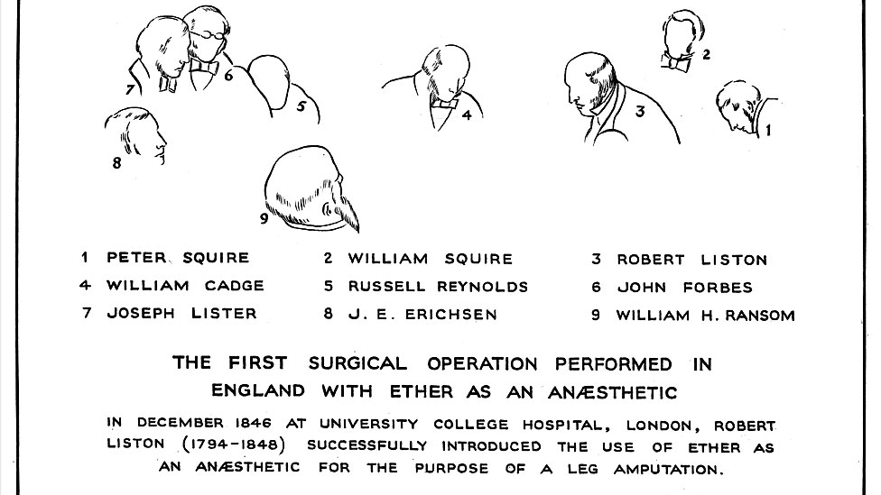Plan de la "primera operación quirúrgica realizada en Inglaterra con éter como anestésico", como indica el documento, en el que se nombra a los presentes. Robert Liston es el #3.