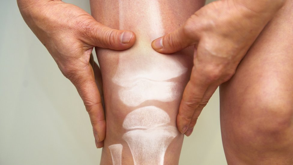 Un hombre se toca la pierna y se muestra con rayos X sus huesos.