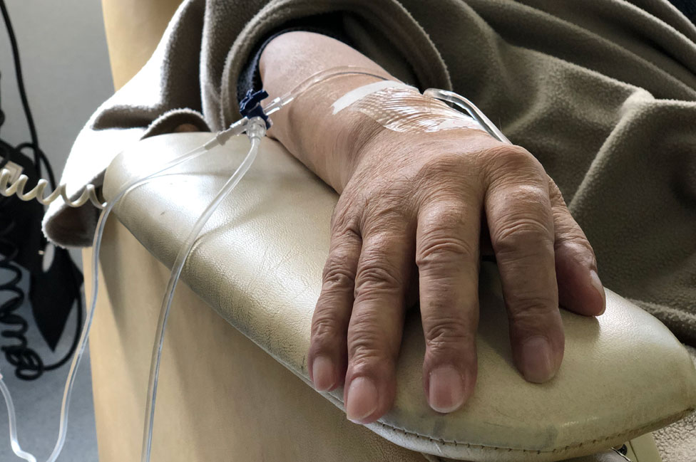 Una paciente recibe un tratamiento de quimioterapia