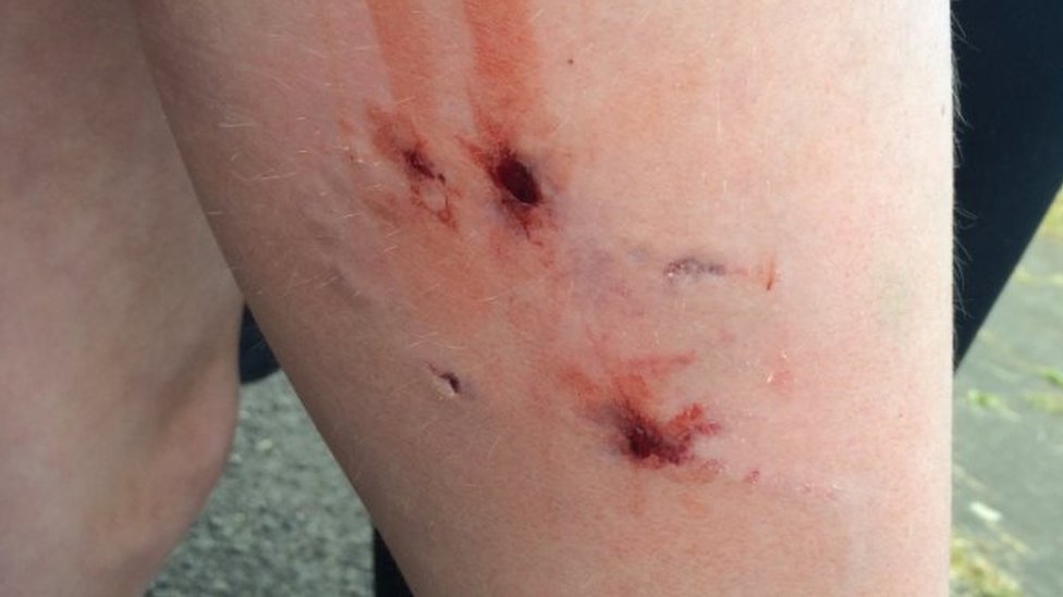 Eleven children injured in Blyth park dog attack BBC News