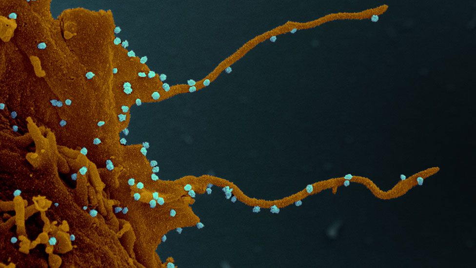 La célula infectada, siguiendo las instucciones del virus (en azul), desarrolla largos tentáculos para infectar otras células.