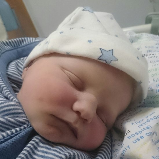 baby head heart monitor