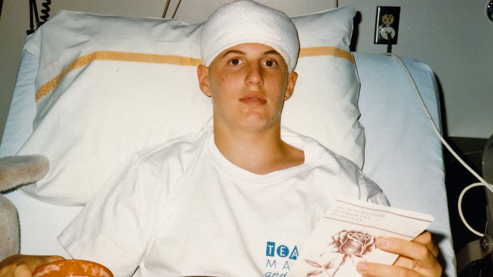 Джефф в больнице Хантингтона через пять дней после операции на головном мозге (август 1986 г.)