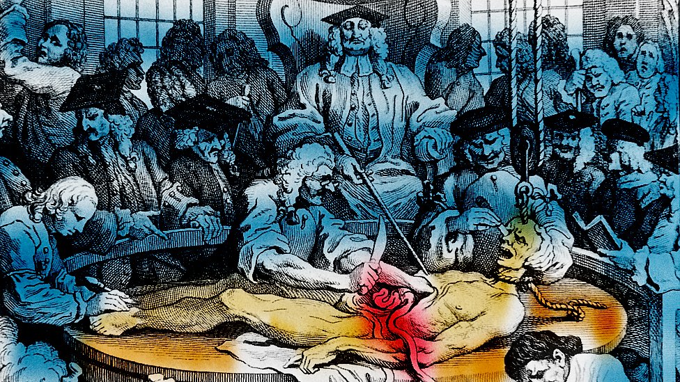 Las autopsias, así como las ejecuciones, se hacían frente al público. Caricatura de autopsia en el siglo XIX