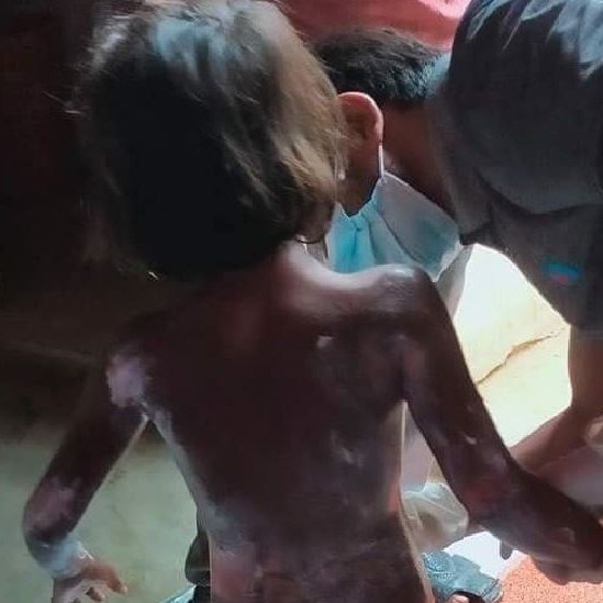 pengungsi Rohingya, kebakaran di kamp pengungsi Rohingya