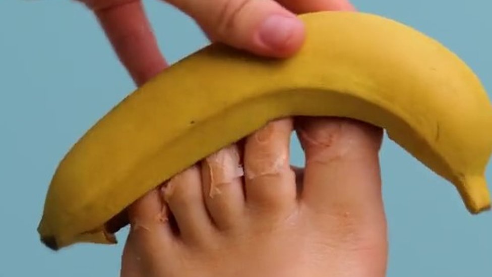 A banana on some toes