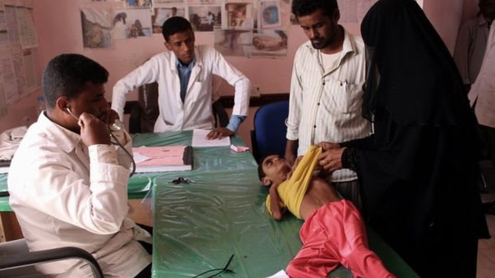 طفل يعاني من سوء التغذية بسبب شح الغذاء في اليمن