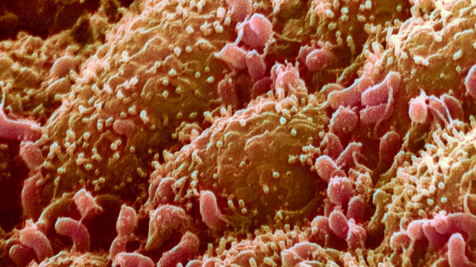Imagen tomada con un microscopio de bacterias en la superficie del intestino