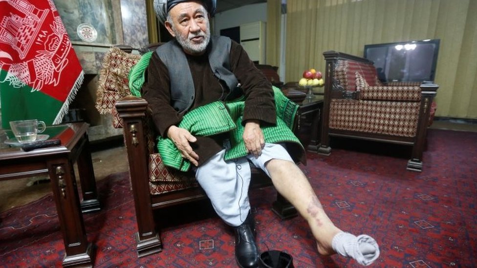 Ахмад Эши показывает травму ноги в Кабуле, Афганистан. Фото: 13 декабря 2016 г.