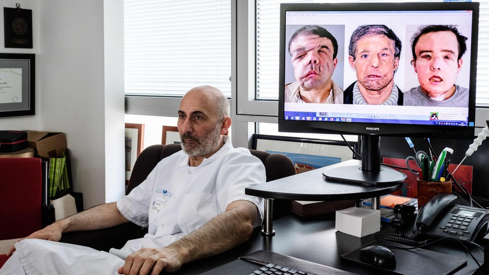Профессор французской медицины Лоран Лантьери, специалист по пересадке рук и лица, позирует рядом с экраном, на котором показаны различные этапы операции своего пациента Джерома Хамона
