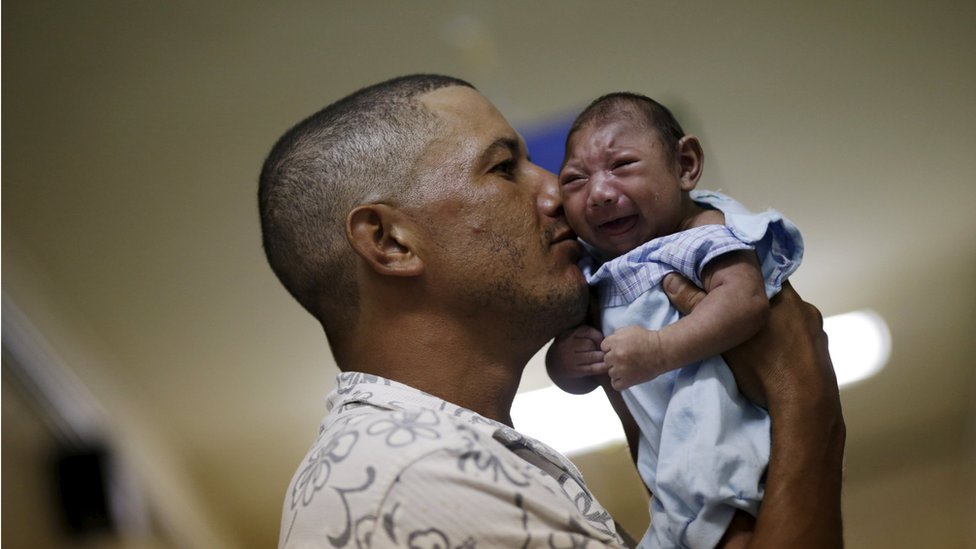 Джеоване Силва держит своего сына Густаво Энрике, страдающего микроцефалией, в больнице Освальдо Крус в Ресифи, Бразилия