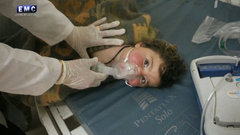 Estados Unidos acusó a Siria de atacar con armas químicas a civiles. Niño atendido por un médico