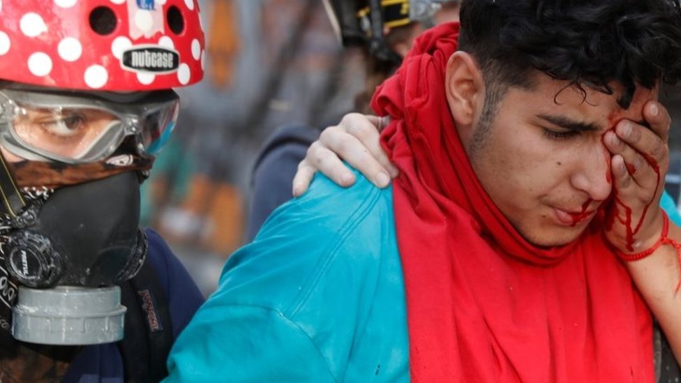Раненый демонстрант идет во время акции протеста против правительства Чили в Сантьяго, Чили, 15 ноября 2019 года.