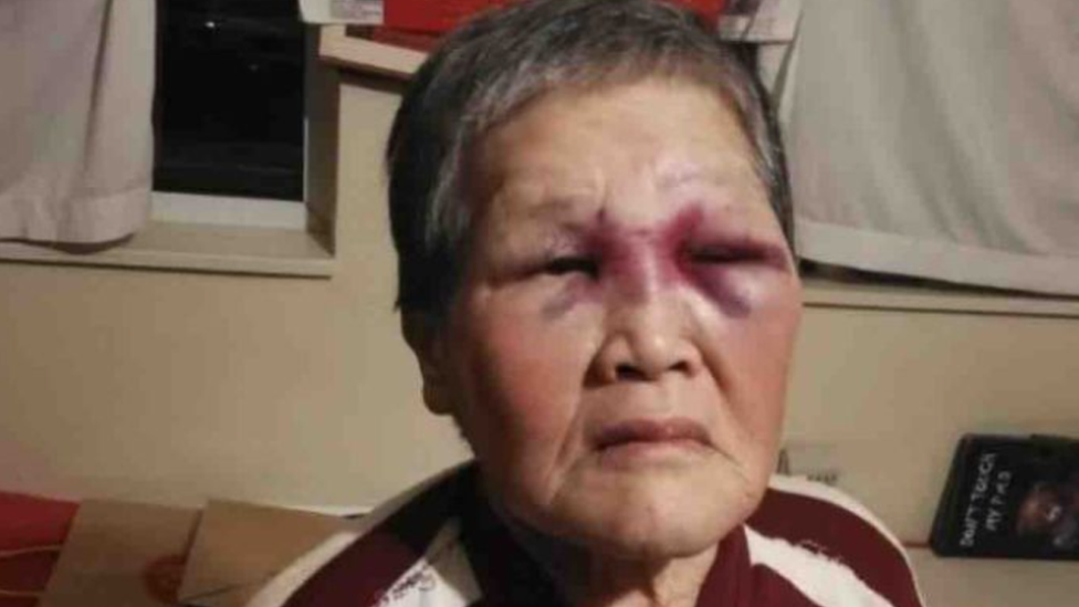 Chinese granny who fought off attacker in US praised for bravery - BBC News