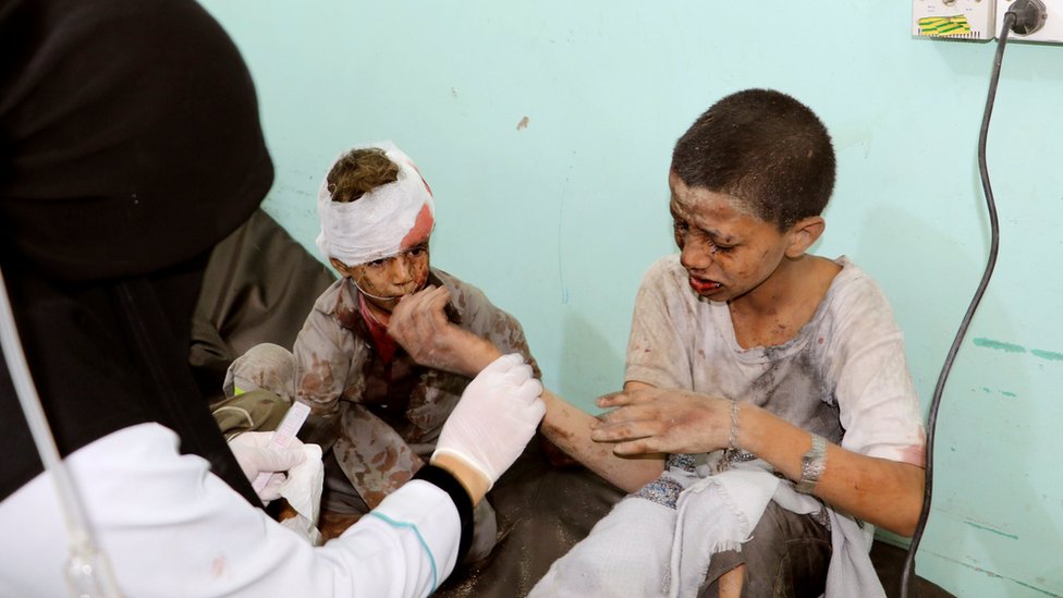 Врач лечит детей, пострадавших в результате авиаудара коалиции под руководством Саудовской Аравии в провинции Саада, Йемен (9 августа 2018 г.)