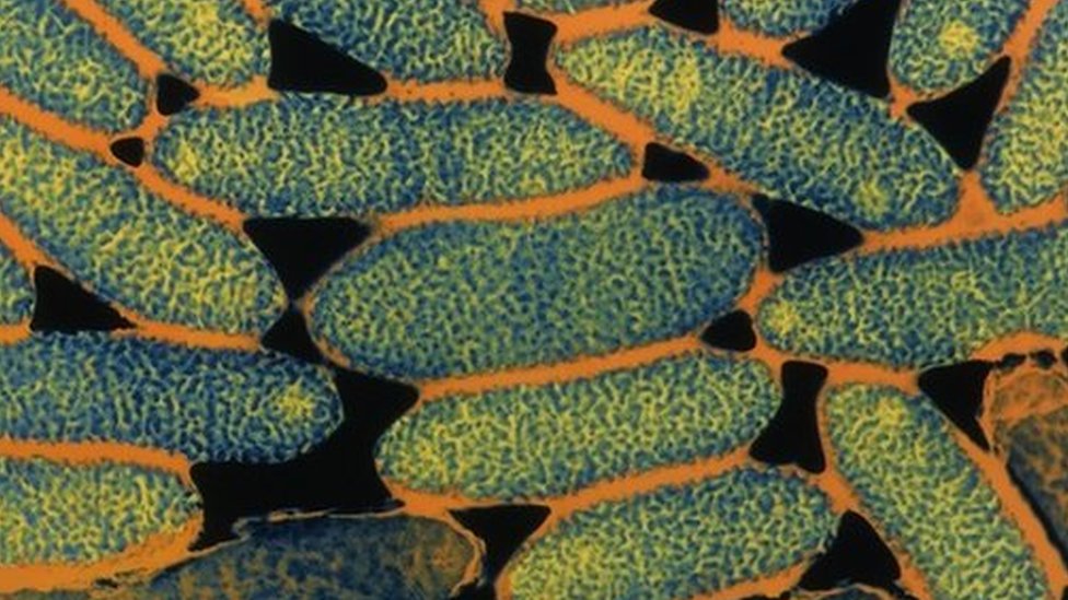 Крупным планом - бактерии легионеллы