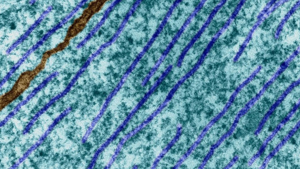 Los microtúbulos son proteínas que se encuentran en las células. Microtúbulos dentro de una célula