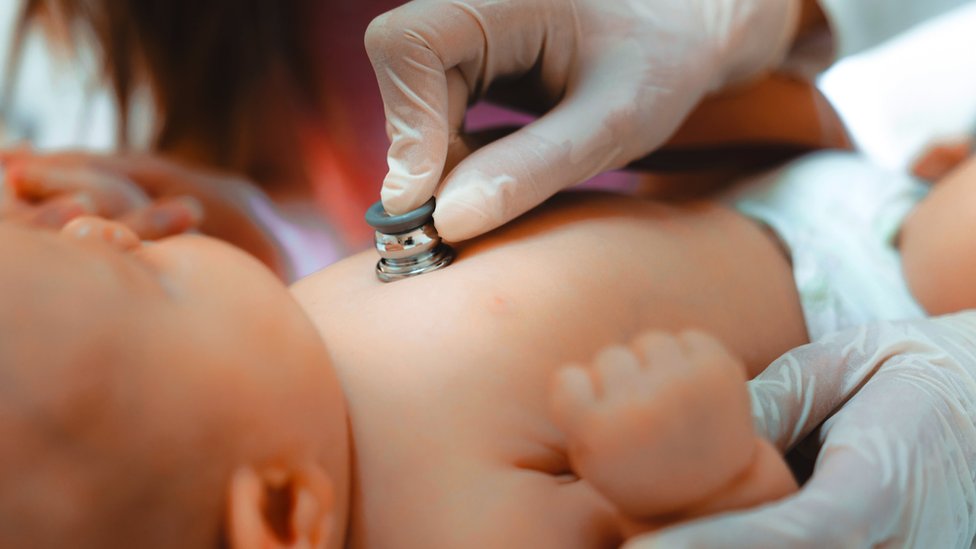 A baby's heart rate being checked by a doctor