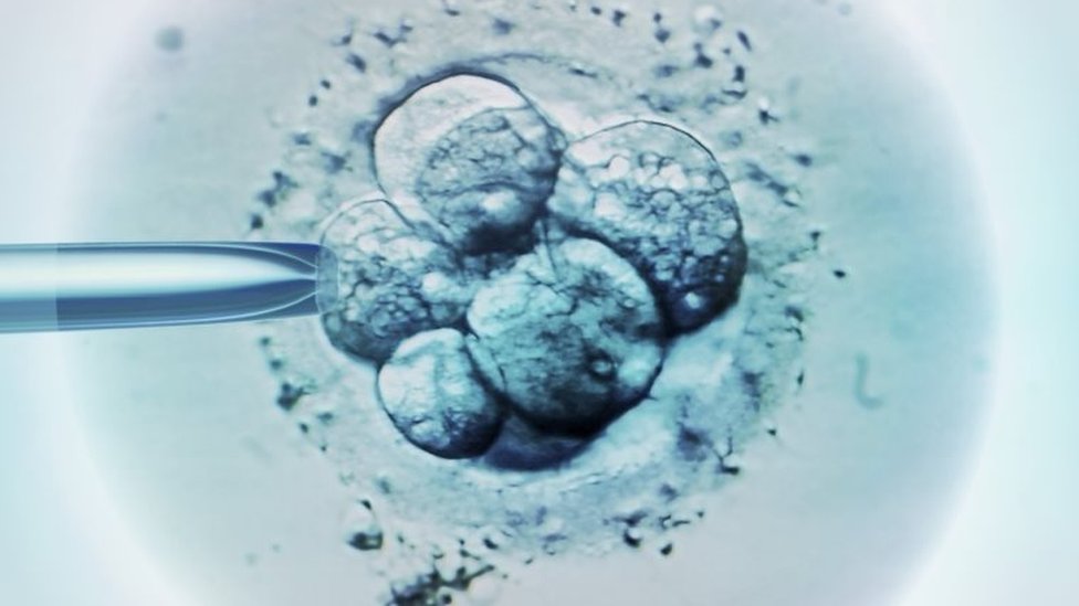Выбор эмбрионов ЭКО