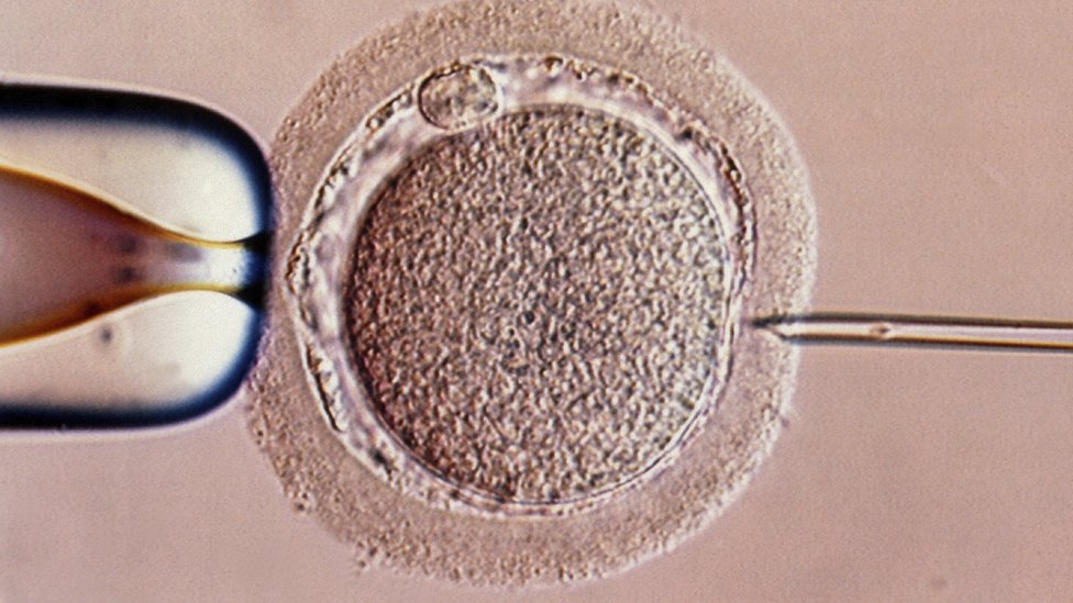 IVF