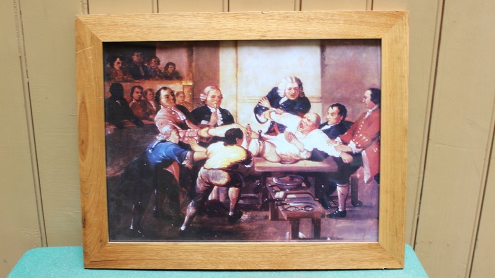 Los ayudantes o dressers, sujetaban a los pacientes y asistían al cirujano durante la operación. Cuadro que muestra operación en el 1800