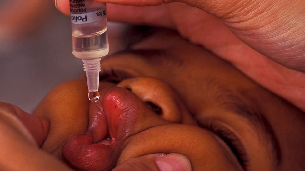 Bebé recibiendo la vacuna de la polio