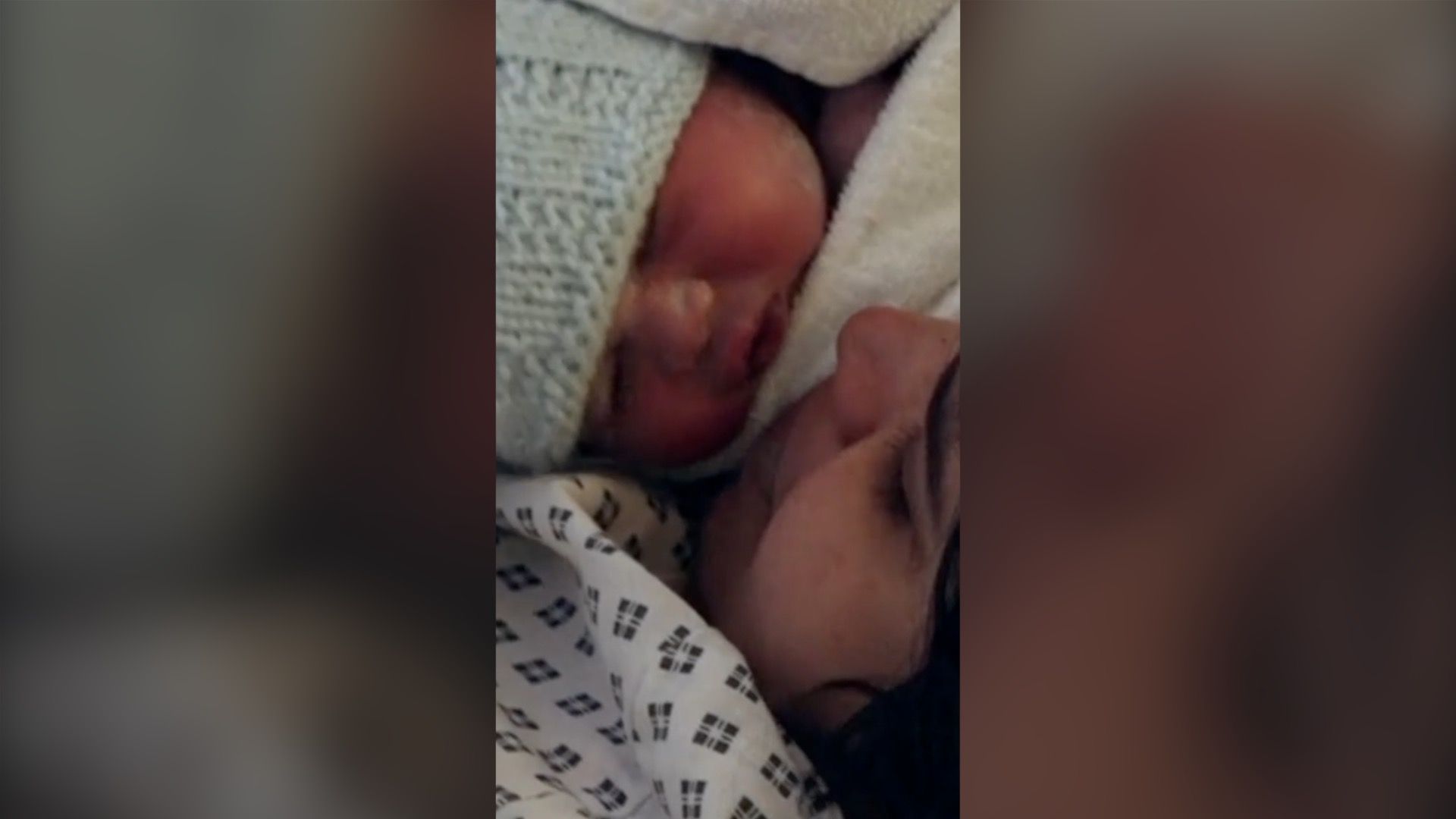 1 in 4 births in England now by emergency C-section